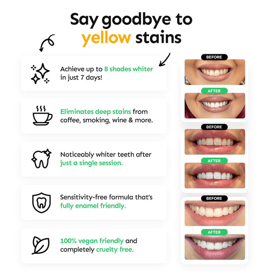 Whites Beaconsfield Teeth Whitening Strips 28 Strips - Non-Peroxide Formula